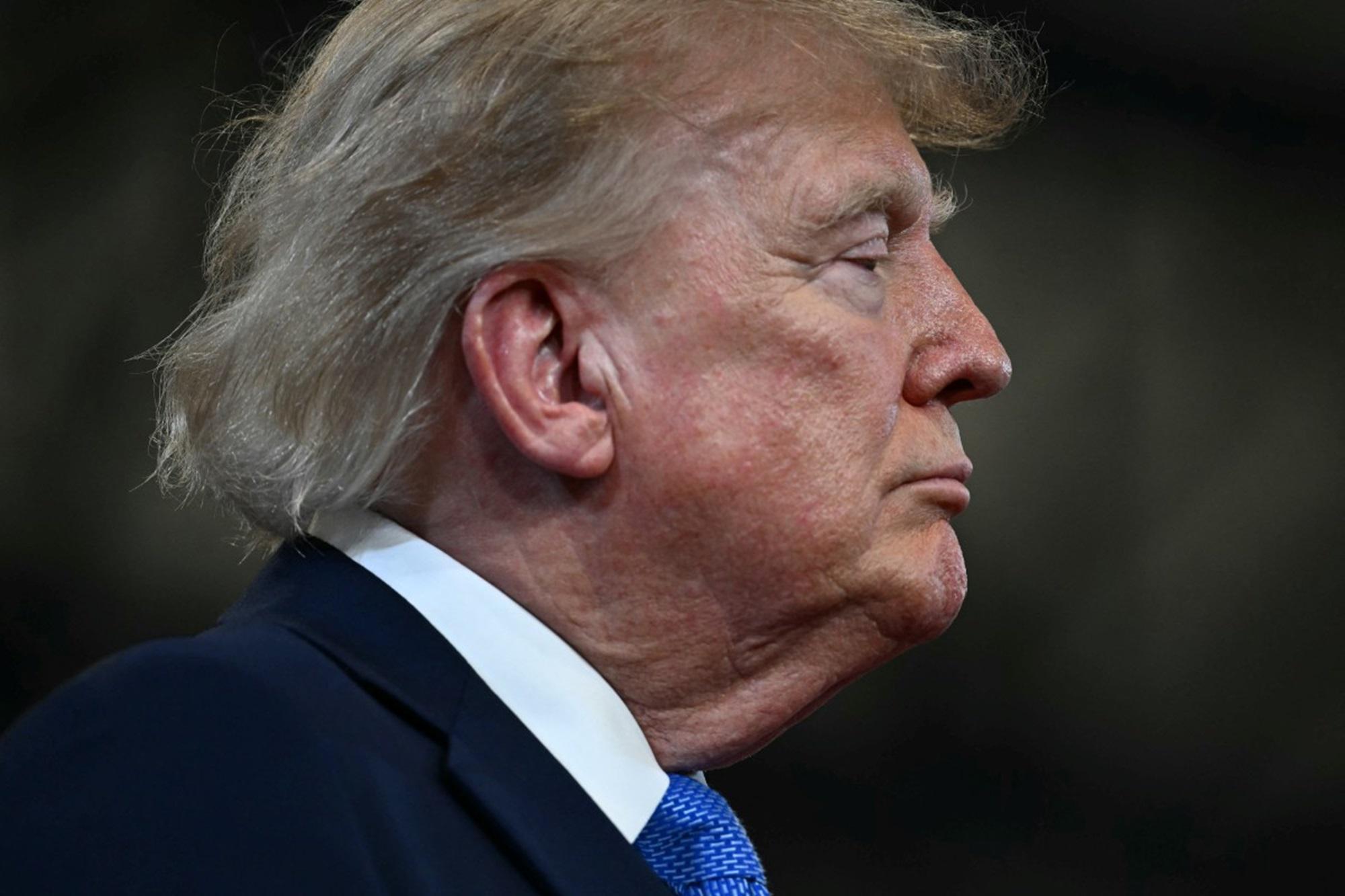 Trump è ingrassato di 10 chili, il parere del medico e l'allarme per il presidente