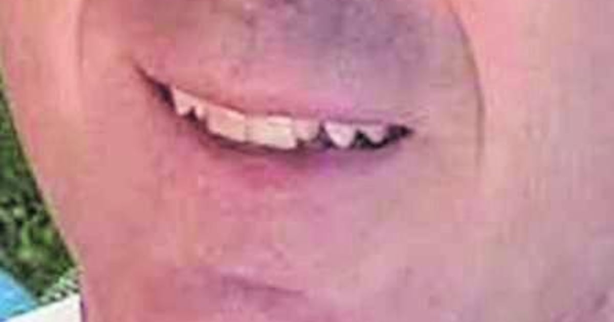 Morto il padre colpito per difendere il figlio